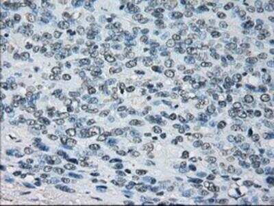 Immunohistochemistry-Paraffin: Peroxiredoxin 4 Antibody (OTI9A3) [NBP2-02117]