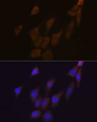 Immunocytochemistry/ Immunofluorescence: Peroxiredoxin 4 Antibody (9E7V0) [NBP3-16760]