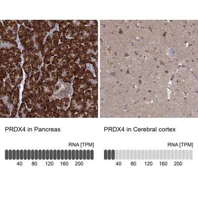 Immunohistochemistry-Paraffin: Peroxiredoxin 4 Antibody [NBP3-17000]