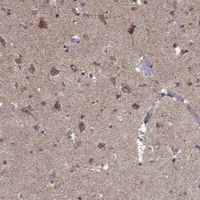 Immunohistochemistry-Paraffin: Peroxiredoxin 4 Antibody [NBP3-17000]