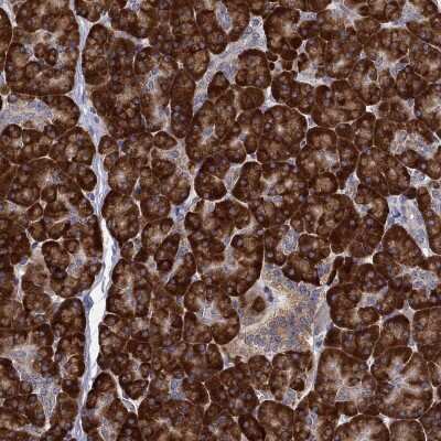 Immunohistochemistry-Paraffin: Peroxiredoxin 4 Antibody [NBP3-17000]