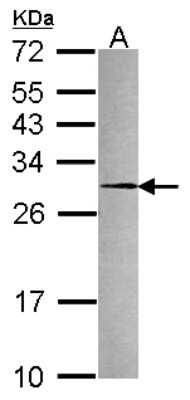 Western Blot: Peroxiredoxin 4 Antibody [NBP2-19778]