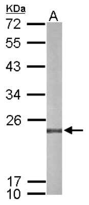 Western Blot: Peroxiredoxin 4 Antibody [NBP2-19778]