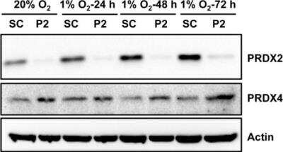 Western Blot: Peroxiredoxin 4 Antibody [NBP2-19778]