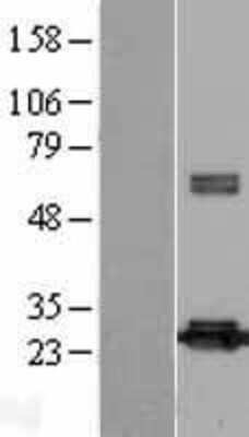 Western Blot: Peroxiredoxin 4 Overexpression Lysate [NBL1-14741]