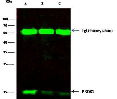 Immunoprecipitation: Peroxiredoxin 5 Antibody (002) [NBP2-89862]