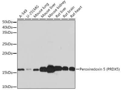 Western Blot: Peroxiredoxin 5 Antibody (5E10D3) [NBP3-16300]