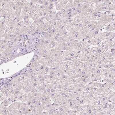 Immunohistochemistry-Paraffin: Peroxiredoxin 5 Antibody [NBP2-38370]