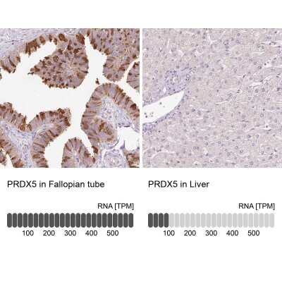 Immunohistochemistry-Paraffin: Peroxiredoxin 5 Antibody [NBP2-38370]