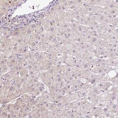 Immunohistochemistry-Paraffin: Peroxiredoxin 5 Antibody [NBP2-38371]
