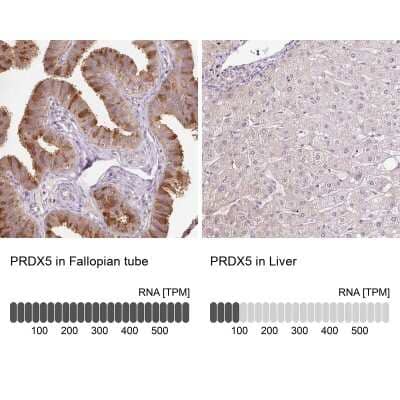 Immunohistochemistry-Paraffin: Peroxiredoxin 5 Antibody [NBP2-38371]