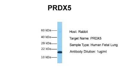 Western Blot: Peroxiredoxin 5 Antibody [NBP1-58348]