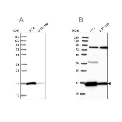Western Blot: Peroxiredoxin 5 Antibody [NBP2-38370]