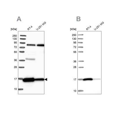 Western Blot: Peroxiredoxin 5 Antibody [NBP2-38371]
