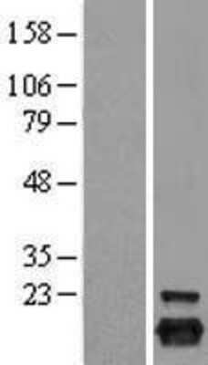 Western Blot: Peroxiredoxin 5 Overexpression Lysate [NBL1-14742]