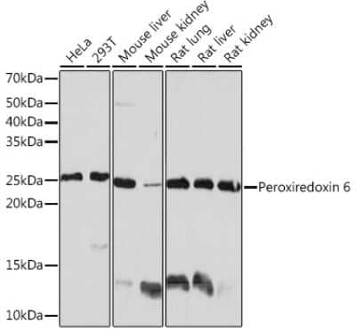 Western Blot: Peroxiredoxin 6 Antibody (1A9W5) [NBP3-16369]