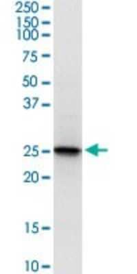 Western Blot: Peroxiredoxin 6 Antibody (3A10-2A11) [H00009588-M01]