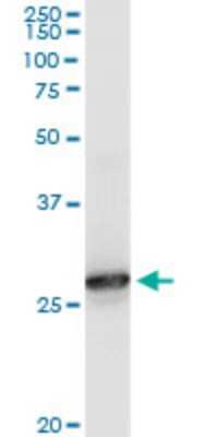 Western Blot: Peroxiredoxin 6 Antibody (3A10-2A11) [H00009588-M01]