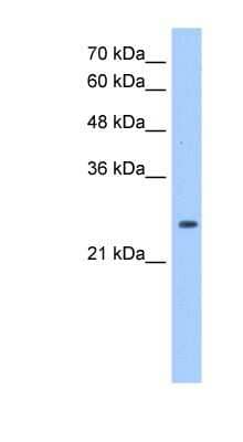 Western Blot: Peroxiredoxin 6 Antibody [NBP1-55159]