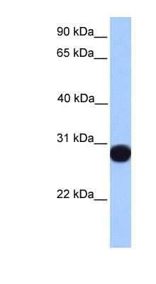 Western Blot: Peroxiredoxin 6 Antibody [NBP1-55160]