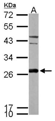 Western Blot: Peroxiredoxin 6 Antibody [NBP2-19779]