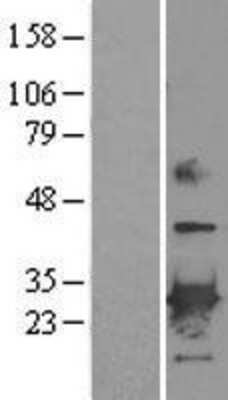 Western Blot: Peroxiredoxin 6 Overexpression Lysate [NBL1-14743]