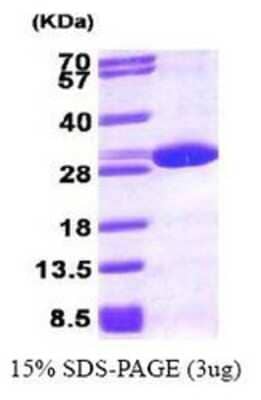 SDS-PAGE: Recombinant Human Peroxiredoxin 6 His Protein [NBP1-30188]