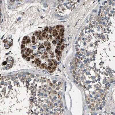 Immunohistochemistry: Peroxiredoxin Like 2C Antibody [NBP1-91073]
