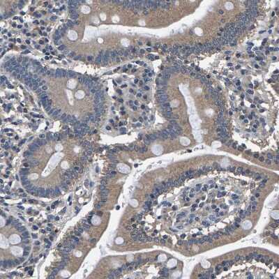 Immunohistochemistry-Paraffin: Peroxiredoxin Like 2C Antibody [NBP1-91073]