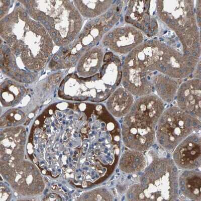 Immunohistochemistry-Paraffin: Peroxiredoxin Like 2C Antibody [NBP1-91073]