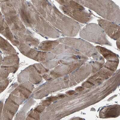 Immunohistochemistry-Paraffin: Peroxiredoxin Like 2C Antibody [NBP1-91073]