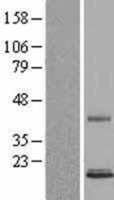 Western Blot: Persephin Overexpression Lysate [NBL1-14914]