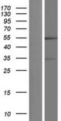 Western Blot: GFR alpha-4/GDNF R alpha-4/Persephin receptor Overexpression Lysate [NBP2-06460]