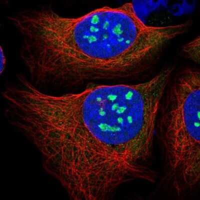 Immunocytochemistry/ Immunofluorescence: Pescadillo Antibody [NBP2-55211]