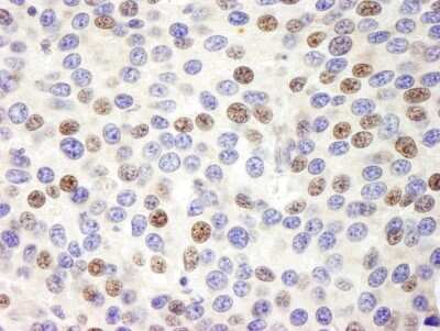 Immunohistochemistry: Pescadillo Antibody [NB110-40548]