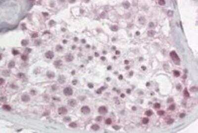 Immunohistochemistry-Paraffin: Pescadillo Antibody [NB100-1258]