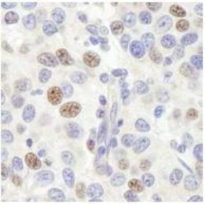 Immunohistochemistry-Paraffin: Pescadillo Antibody [NB110-40548]