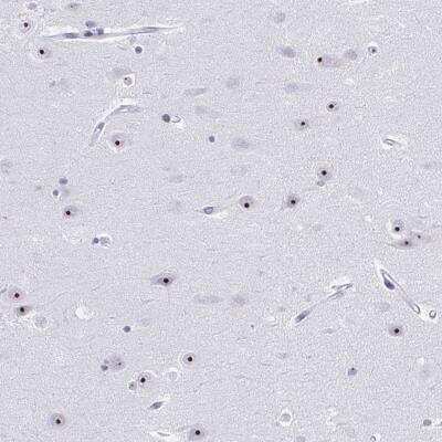 Immunohistochemistry-Paraffin: Pescadillo Antibody [NBP2-34146]