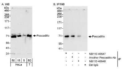 Western Blot: Pescadillo Antibody [NB110-40548]