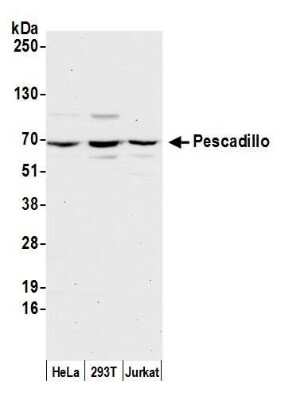 Western Blot: Pescadillo Antibody [NB110-40548]