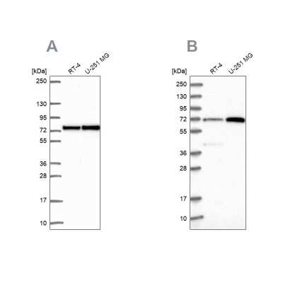 Western Blot: Pescadillo Antibody [NBP2-34146]