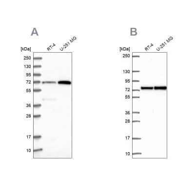 Western Blot: Pescadillo Antibody [NBP2-55211]