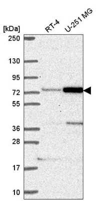 Western Blot: Pescadillo Antibody [NBP2-56329]