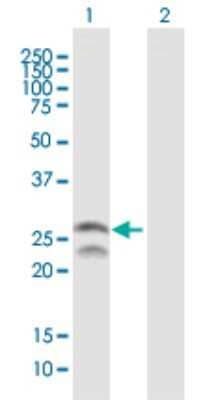 Western Blot: Pet1 Antibody [H00054738-B02P]