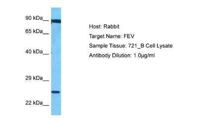 Western Blot: Pet1 Antibody [NBP2-85457]