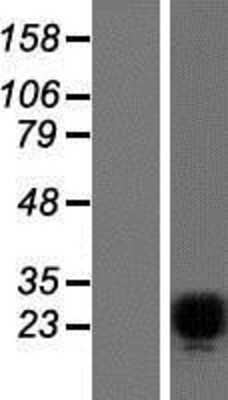 Western Blot: Pet1 Overexpression Lysate [NBP2-06972]