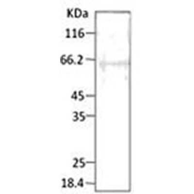 Western Blot: PfHsp40 Antibody [NBP3-18240]