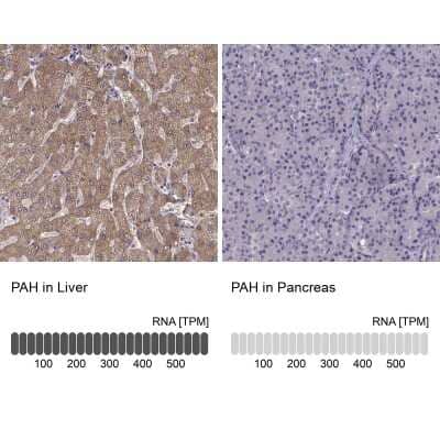 Immunohistochemistry-Paraffin: Phenylalanine Hydroxylase Antibody [NBP1-80917]