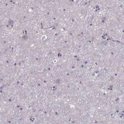 Immunohistochemistry-Paraffin: Phenylalanine Hydroxylase Antibody [NBP1-80917]