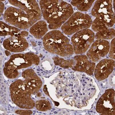 Immunohistochemistry-Paraffin: Phenylalanine Hydroxylase Antibody [NBP1-80917]